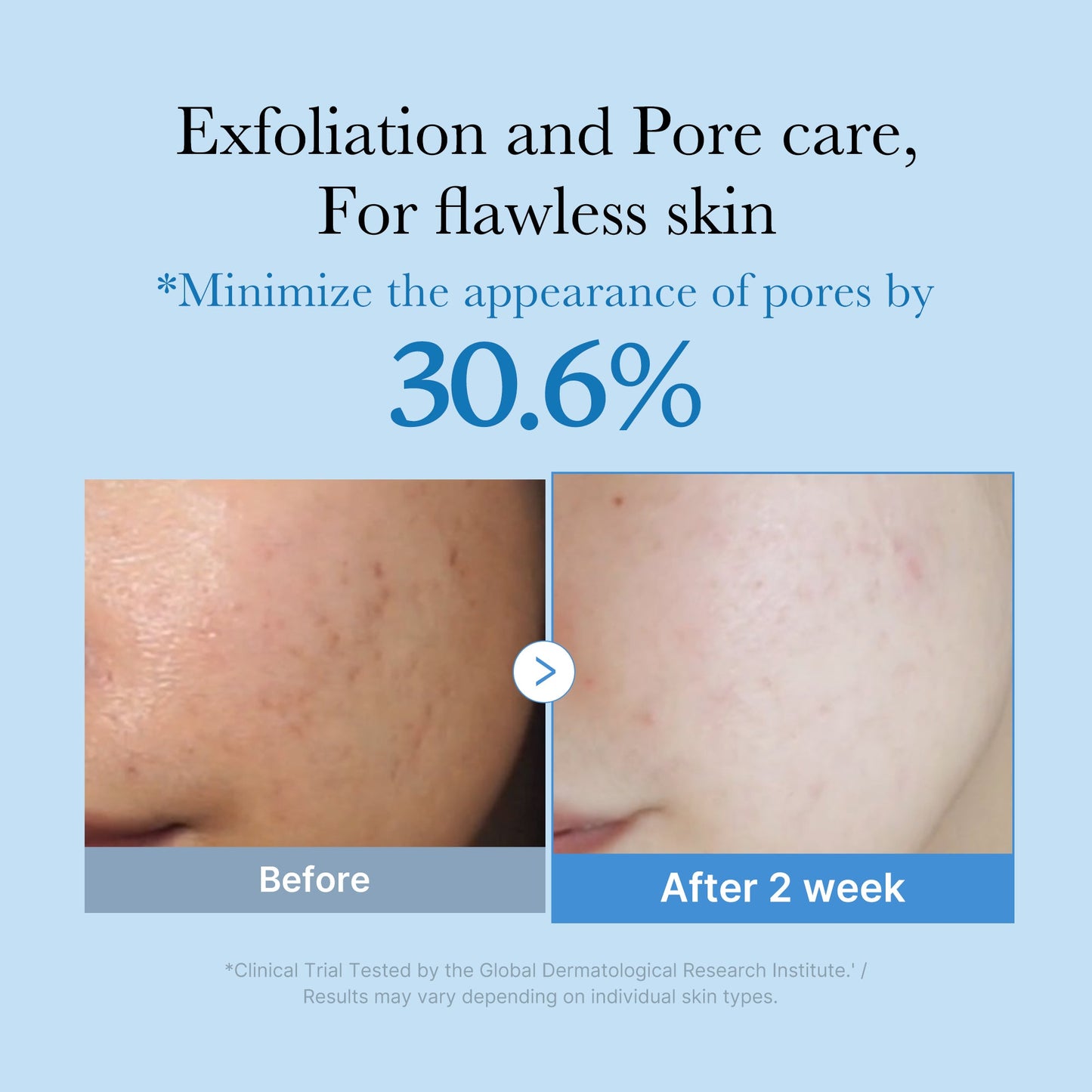 zero-pore-toner-y4 01_d6480b4e-3c08-4954-994a-ed5212c1839c.jpg