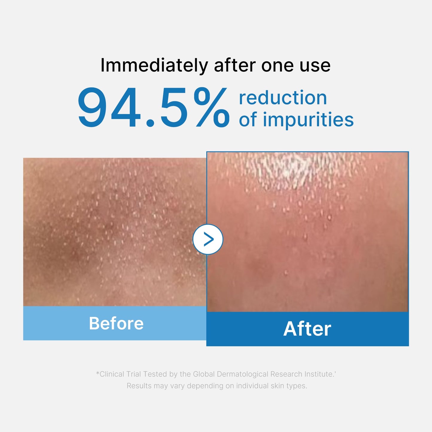 zero-pore-blackhead-deep-cleansing-oil-a0 01_eed557ec-5857-46a2-8b17-dbd67c692dcb.jpg