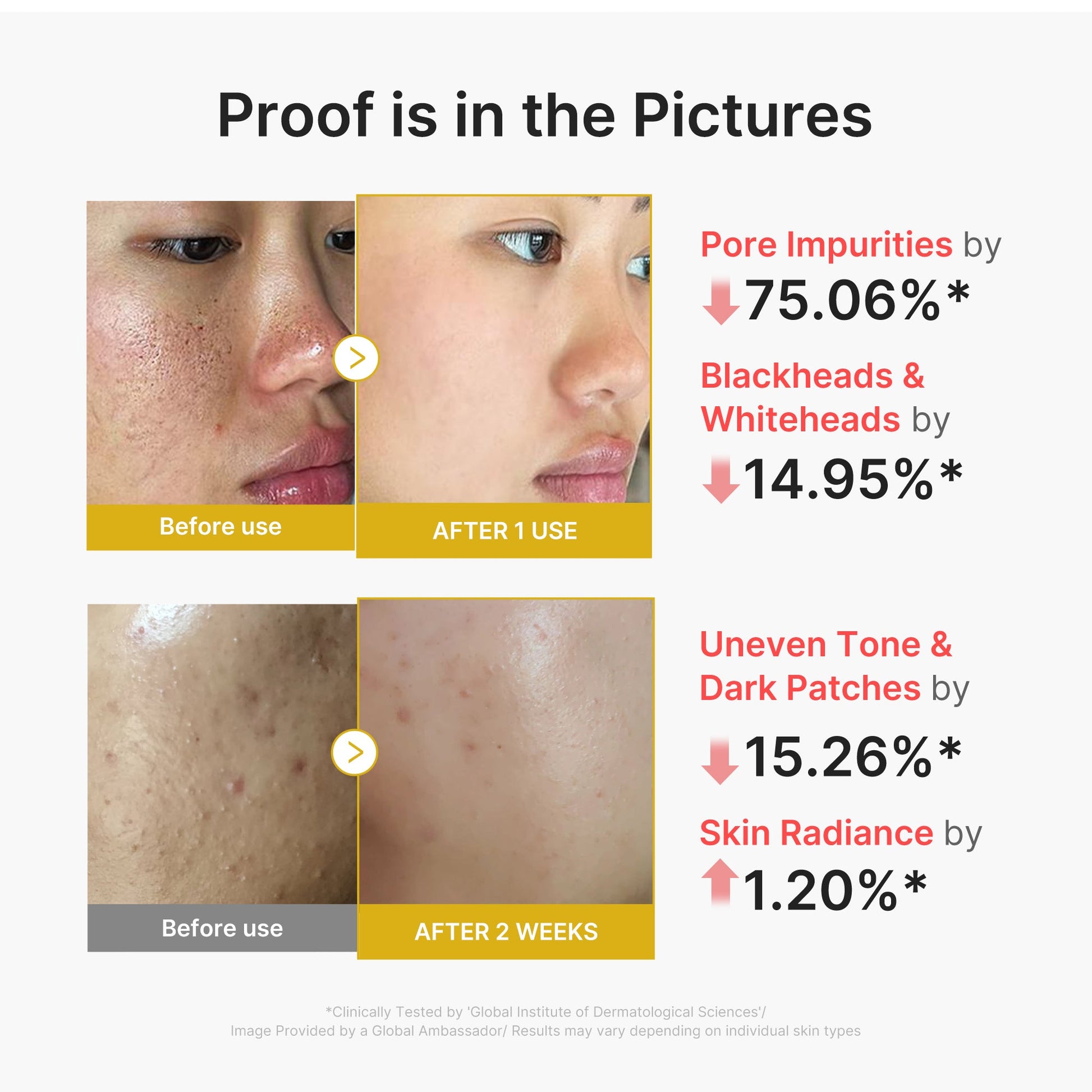 kojic-acid-turmeric-peel-shot-v1 02_45fe66d3-b3f6-4100-aa52-2afd7eded417.jpg