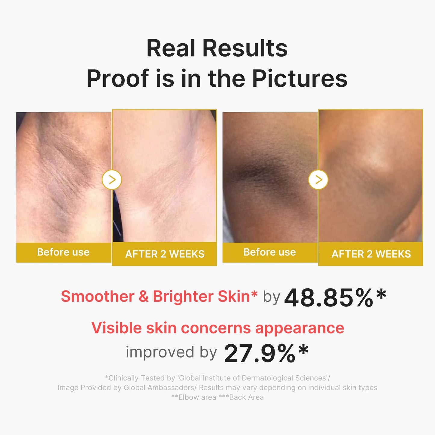 kojic-acid-turmeric-body-peel-shot-w2 02_72880cfc-382b-440b-8152-7e3dce87da2a.jpg