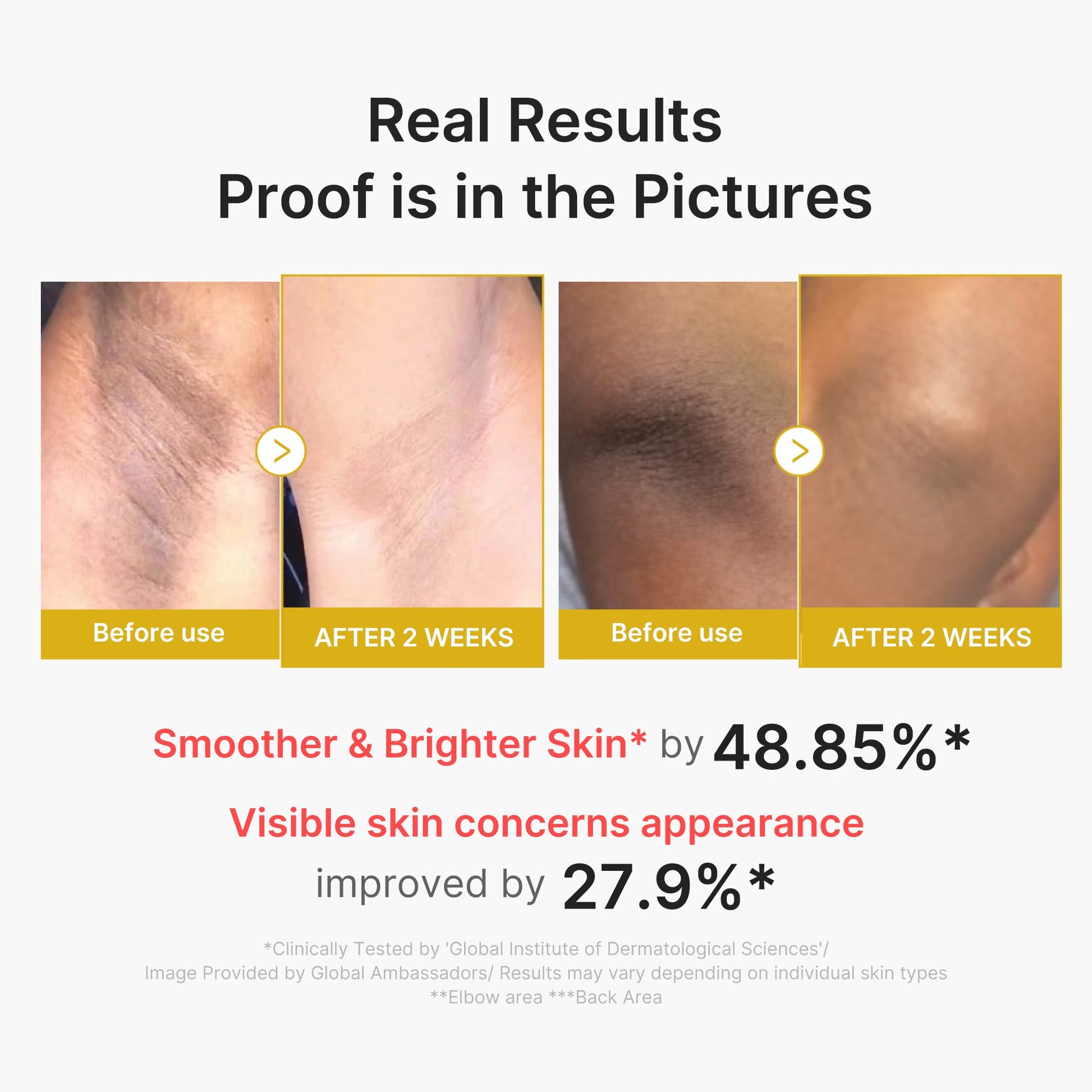 kojic-acid-turmeric-body-peel-shot-w2 02_72880cfc-382b-440b-8152-7e3dce87da2a.jpg
