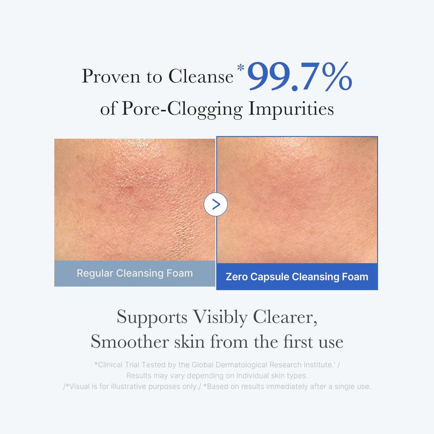 zero-pore-capsule-cleansing-foam-q1 02_c1fb9dfb-86c5-4038-8ff8-490d1006276c.jpg