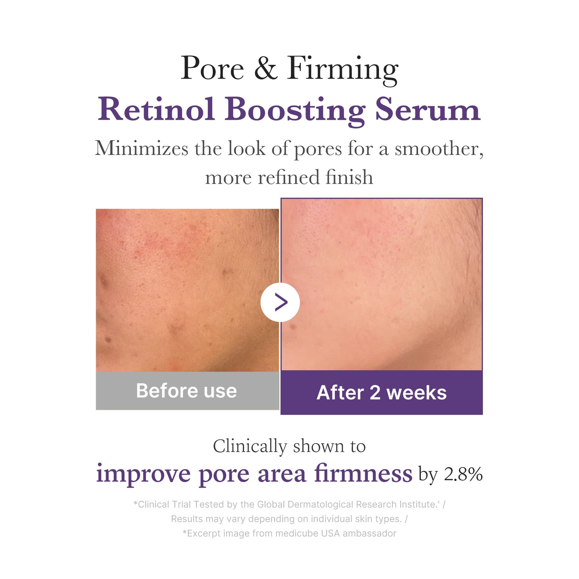 retinol-nmn-boosting-serum-k9 03_3510e7a5-5633-4a18-81ea-1389593bd517.jpg