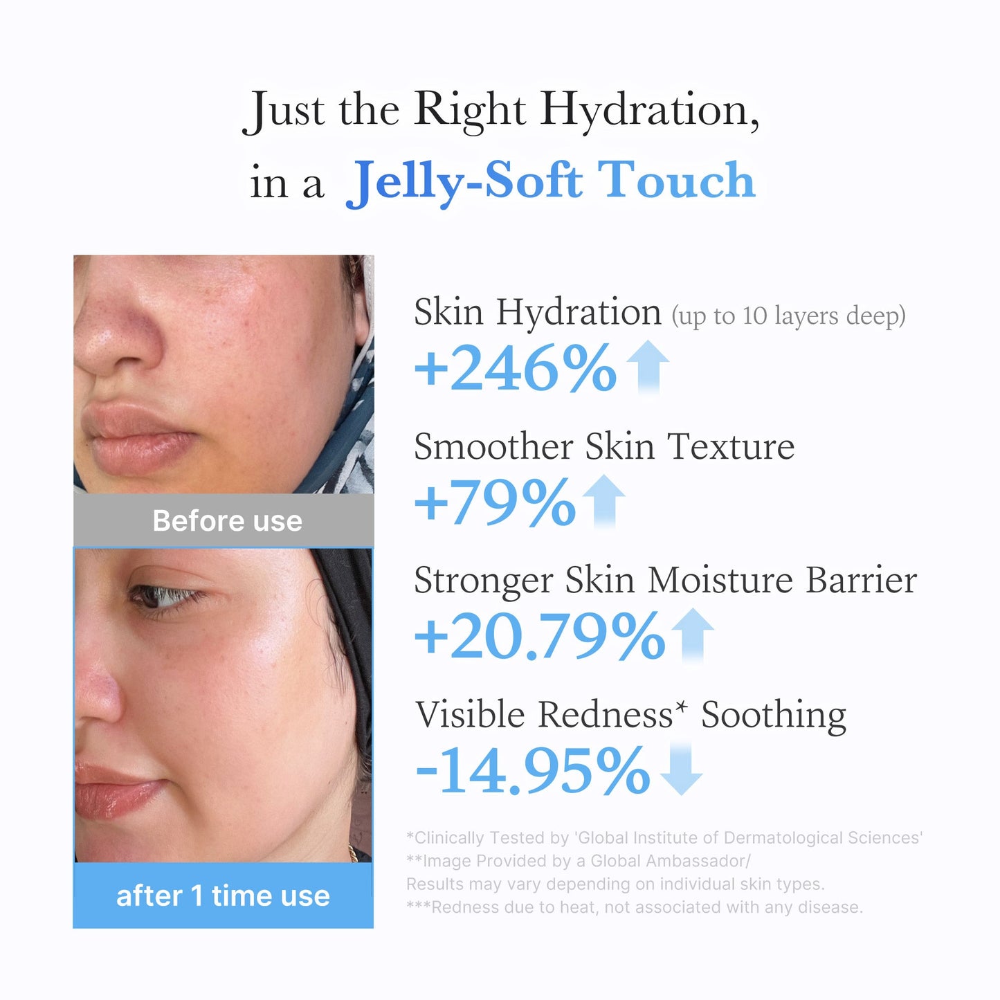 hyaluronic-ceramide-moisturizing-jelly-cream-q6 03_c39d66cc-0839-4e48-ab4a-d32143d06b1c.jpg