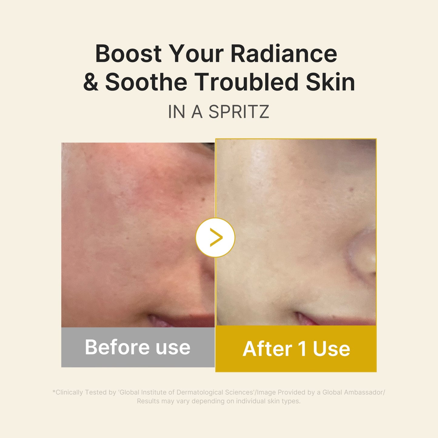 kojic-acid-turmeric-vitamin-gold-jelly-mist-serum-v7 03_dc9cd19e-4e57-49d3-9b66-c7762e8a63f1.jpg