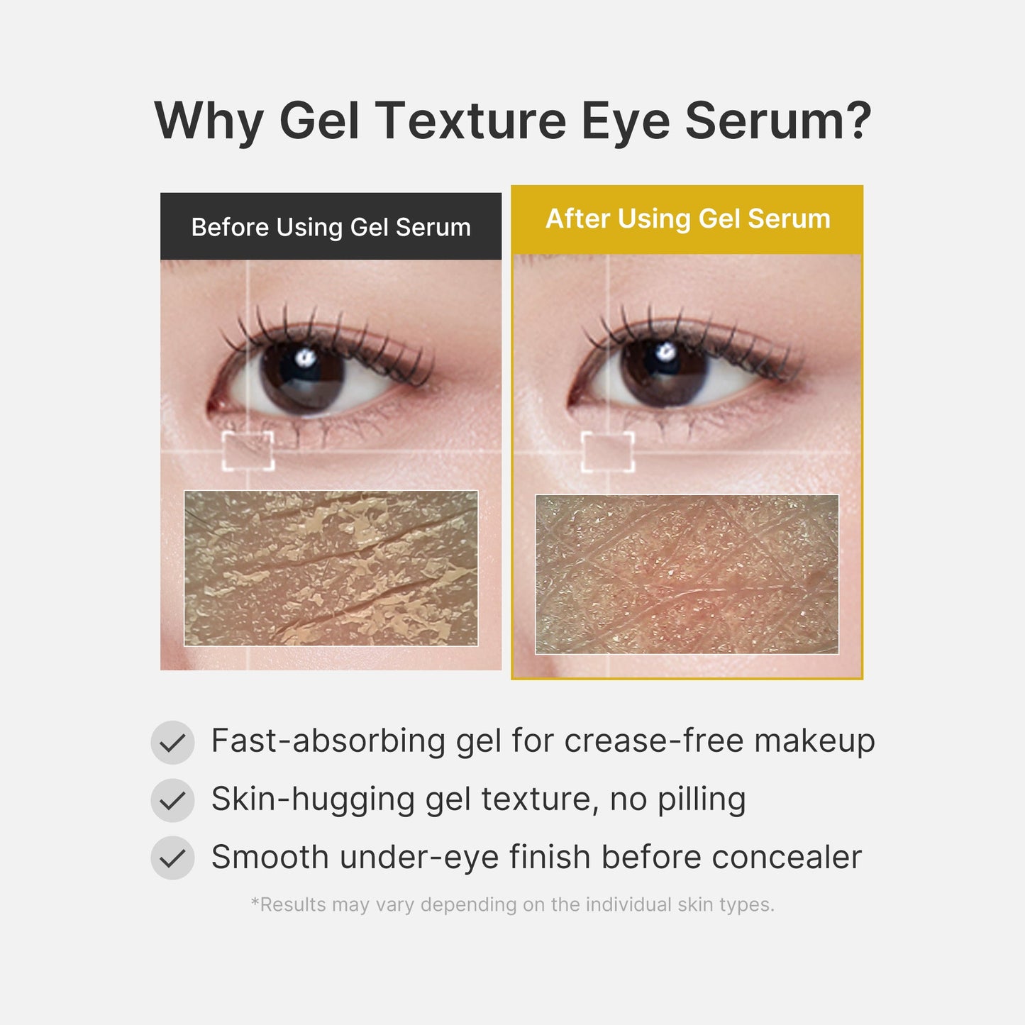 kojic-acid-tumeric-eye-gel-serum-k9 04_0487ef36-49f4-4294-8049-bb55118b05fe.jpg
