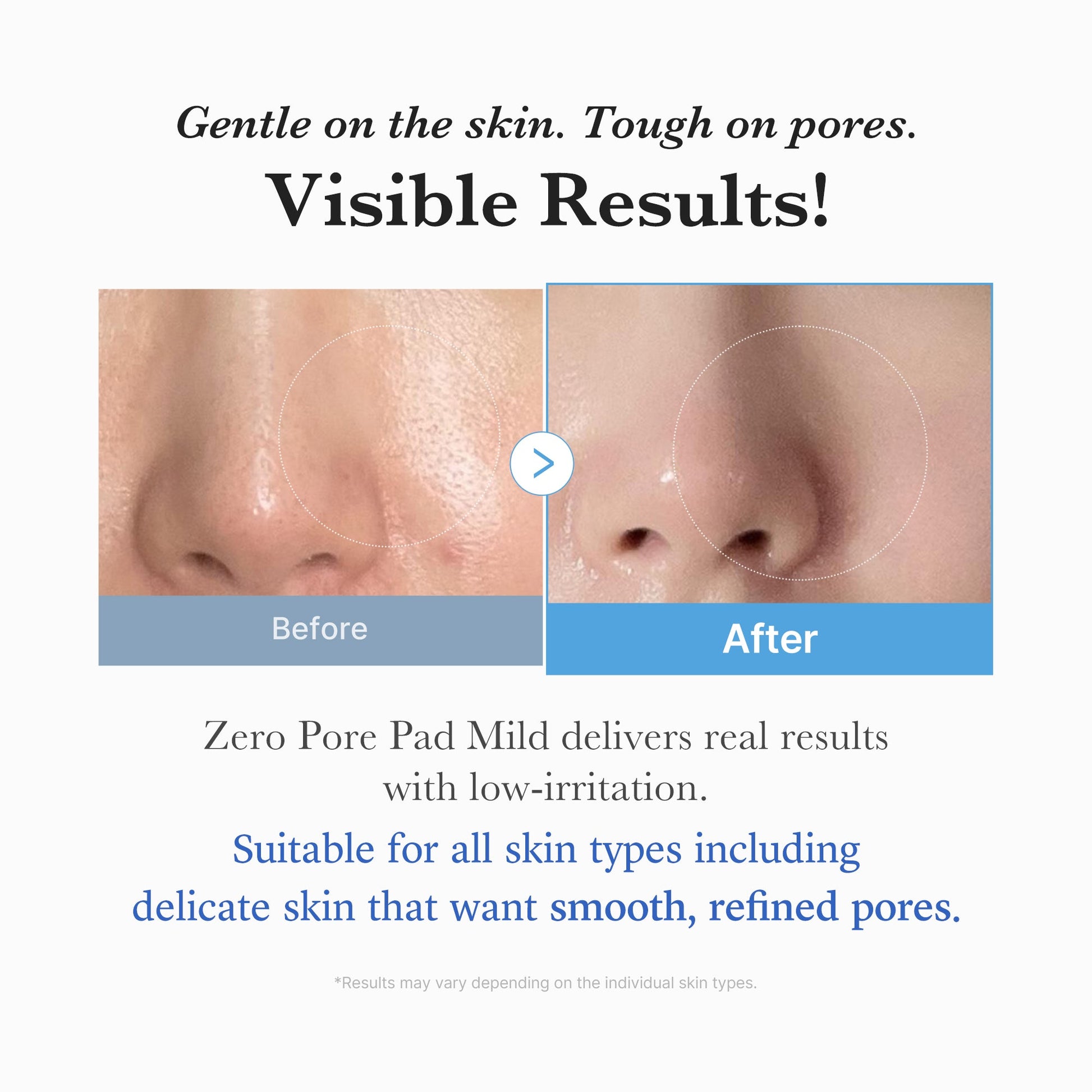 zero-pore-madecassoside-pads-mild-s7 04_6357f9f9-483b-4891-82c6-a58d336e62c8.jpg