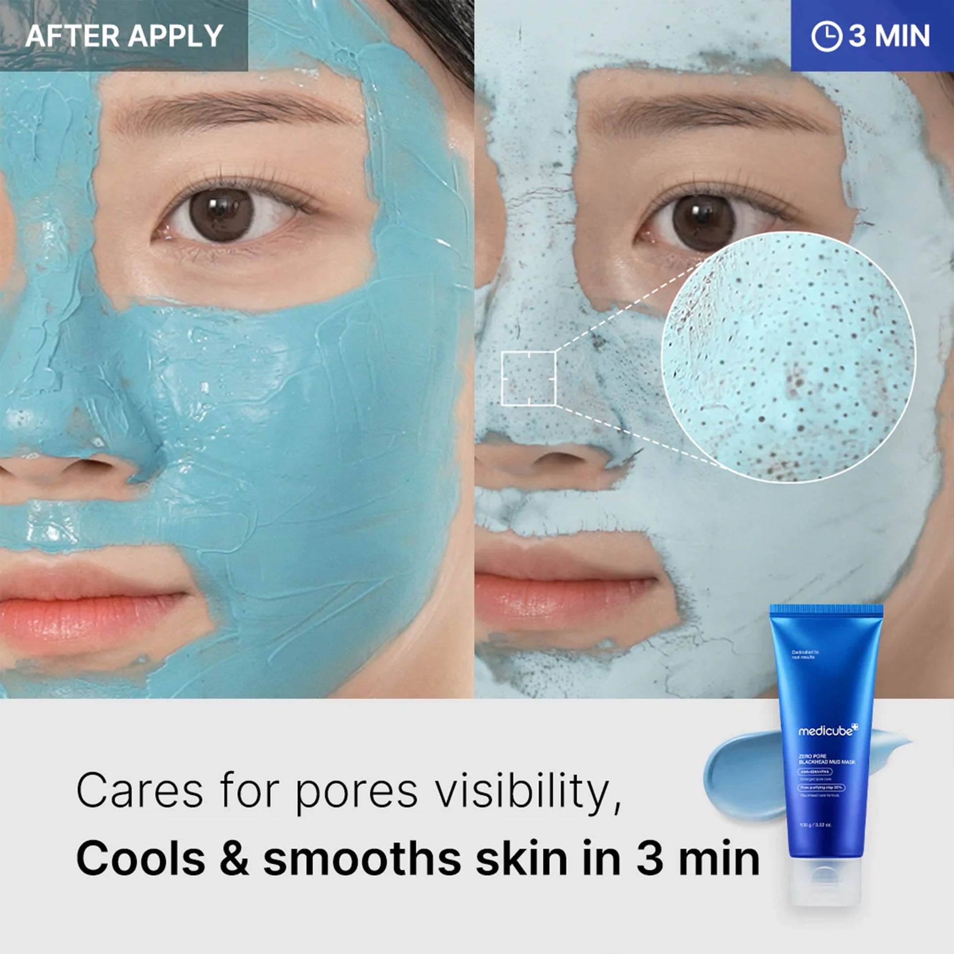 zero-pore-blackhead-mud-mask-s3 04_867c0459-a94e-40d3-bd9a-70400edabe8d.jpg