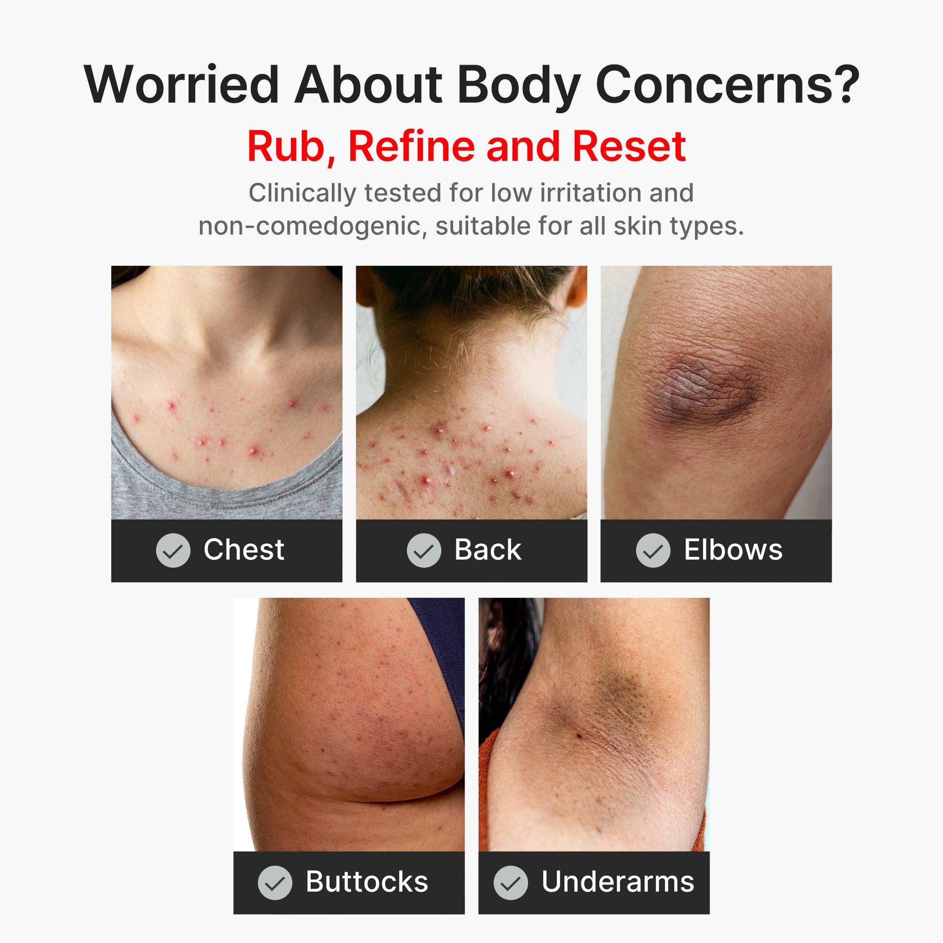 kojic-acid-turmeric-body-peel-shot-w2 04_8a7237f2-3ebf-401e-bd85-54841aeb3efc.jpg