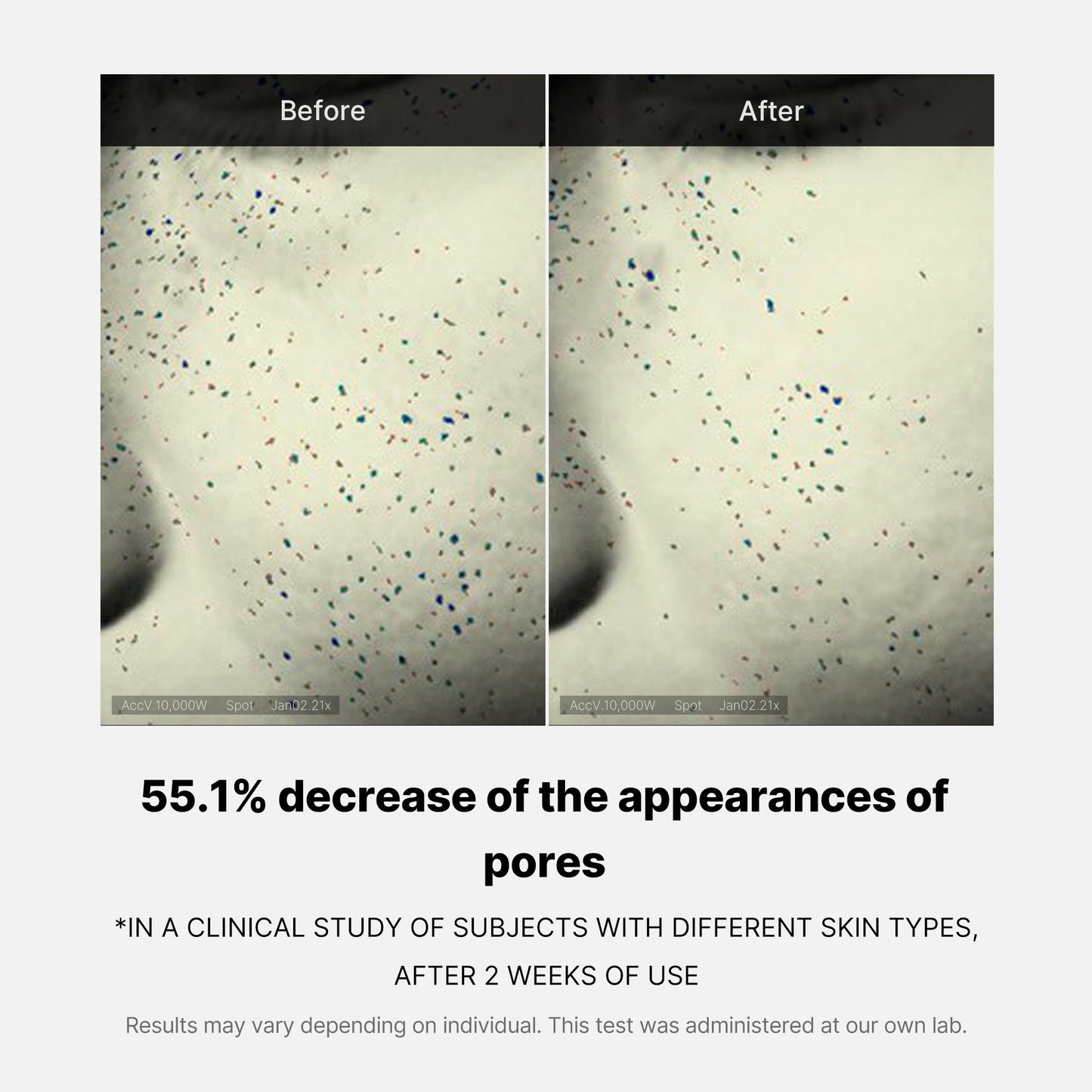 pore-care-duo-x9 05_12ddab8a-64be-4612-8ee1-27e5ec701921.jpg
