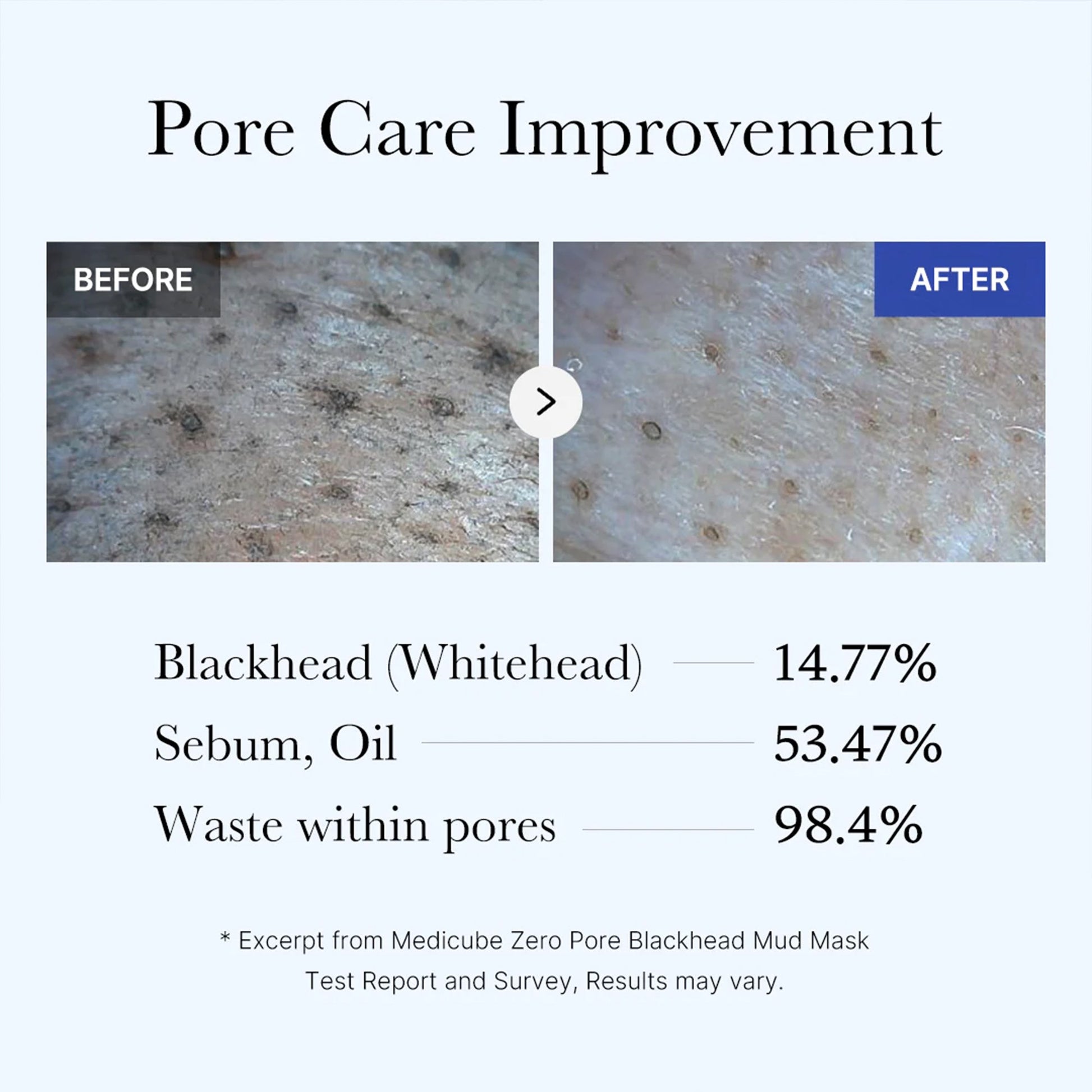 zero-pore-blackhead-mud-mask-s3 05_9362a158-c2b3-4525-acc0-631a2cfdea47.jpg