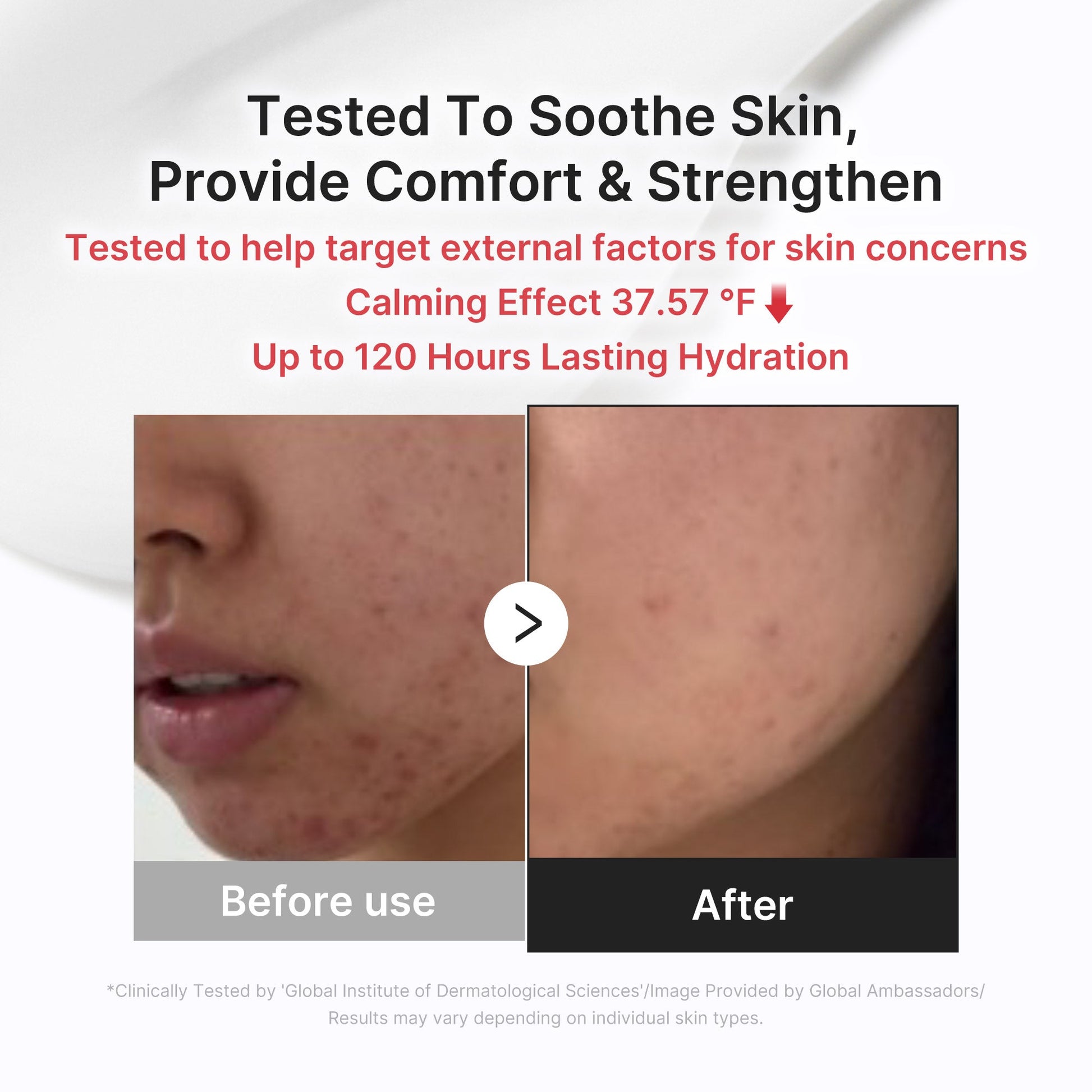3h-daily-relief-cream-b8 3H_03.jpg