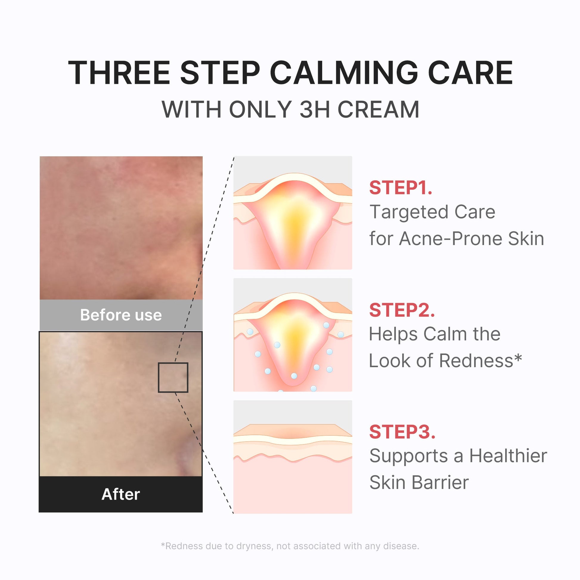 3h-daily-relief-cream-b8 3H_04.jpg