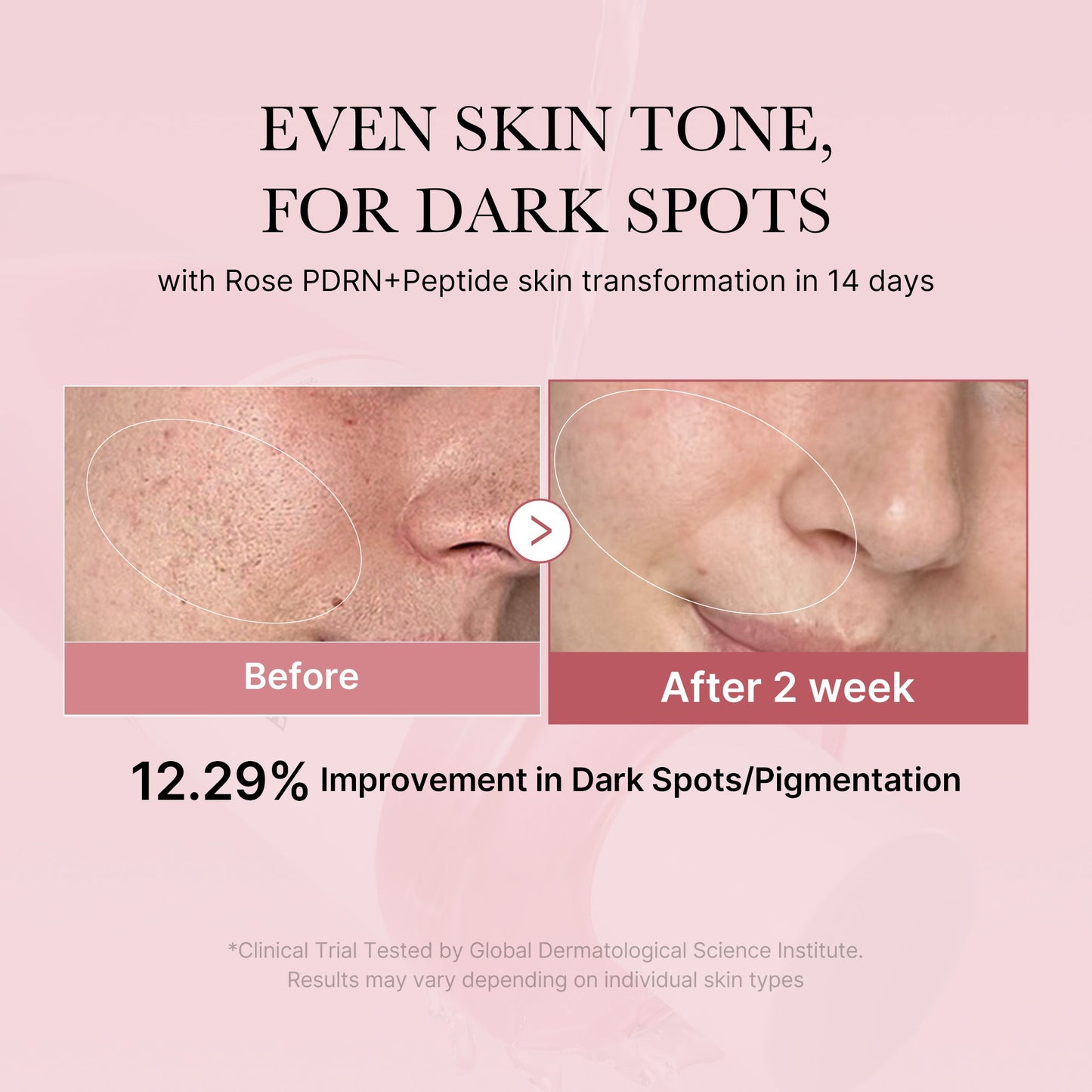 pdrn-pink-peptide-toner-n3 PDRN_01_308c518e-5ac6-4e54-99bd-eabc8796739b.jpg