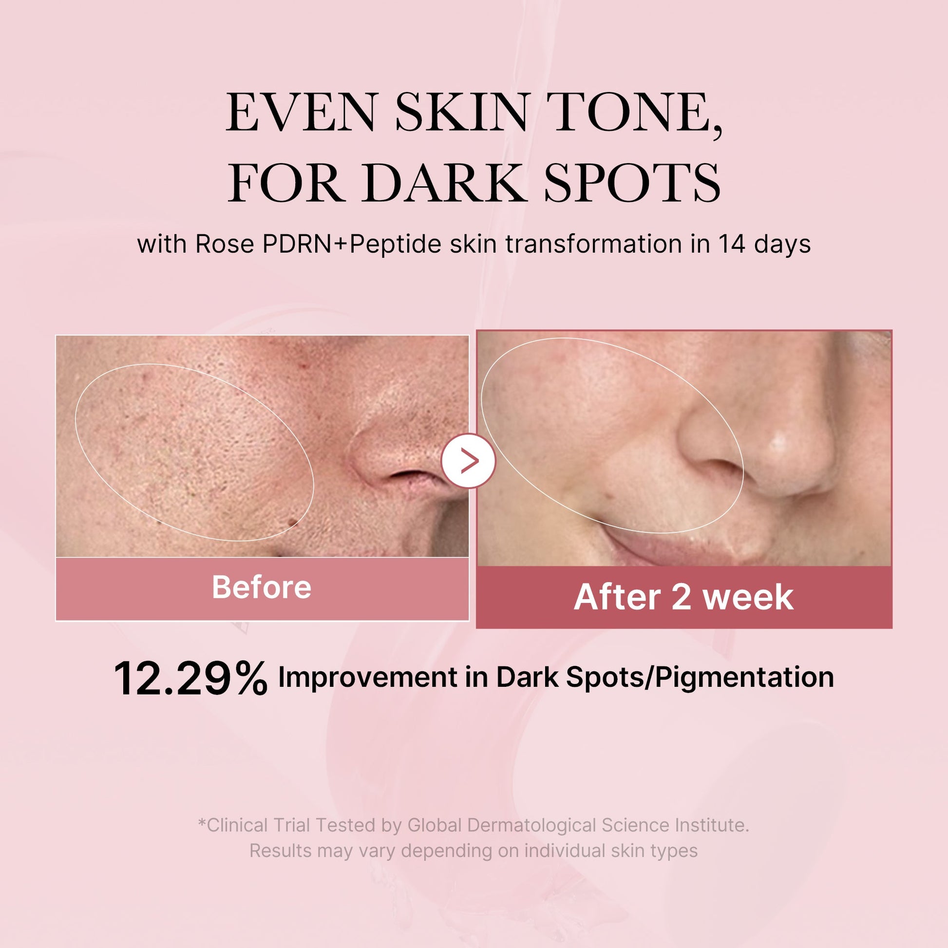 pdrn-pink-peptide-toner-n3 PDRN_01_308c518e-5ac6-4e54-99bd-eabc8796739b.jpg