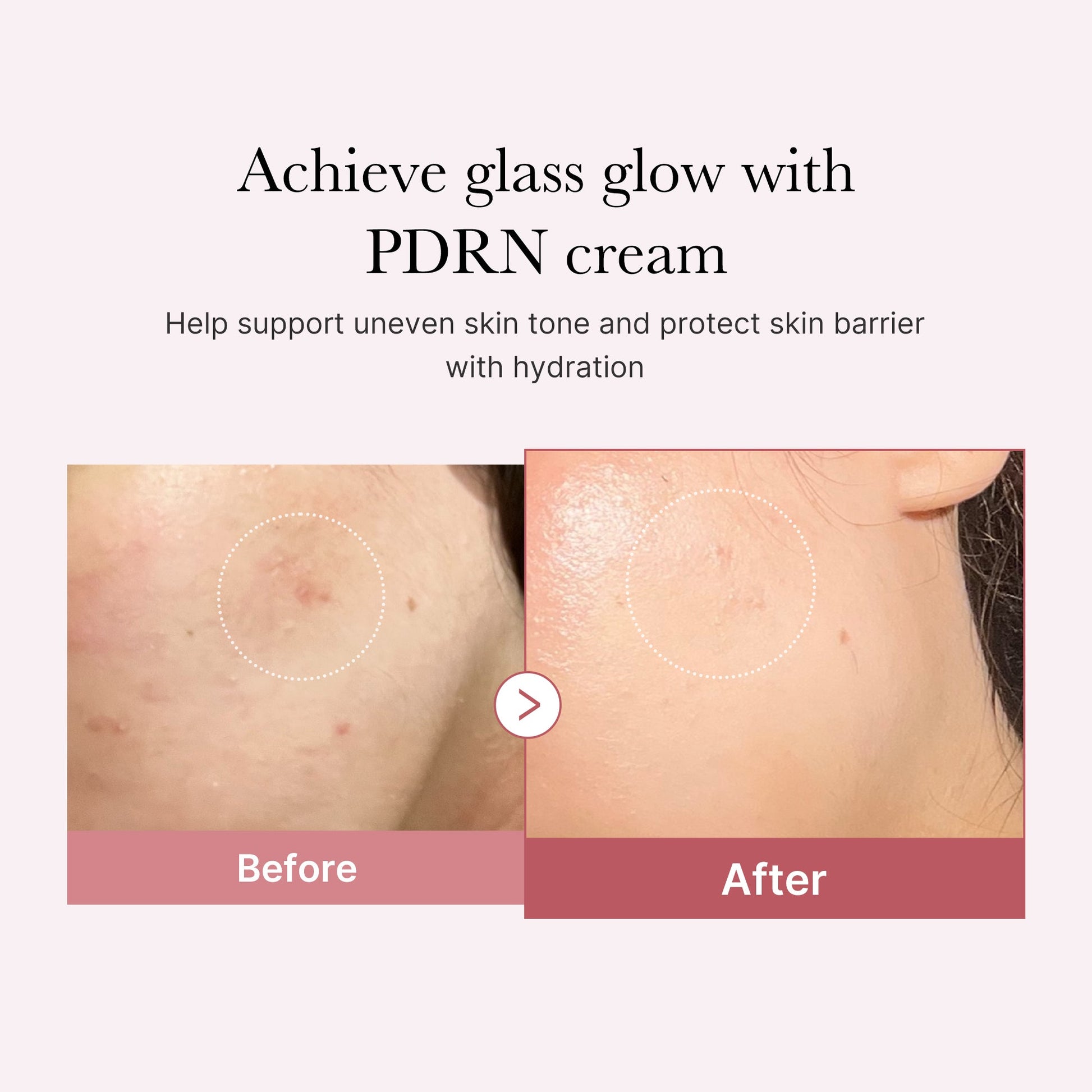 pdrn-pink-peptide-cream-y6 PDRN_02_d7805bfe-cf43-446a-b71b-a276683f136b.jpg