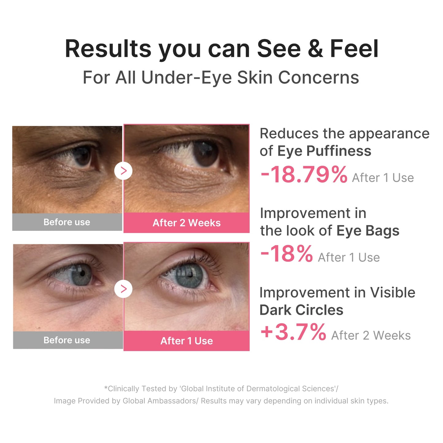 pdrn-caffeine-collagen-eye-patch-l7 PDRN_03_cdce2143-b8d8-43cb-ac69-fcbdf6640249.jpg