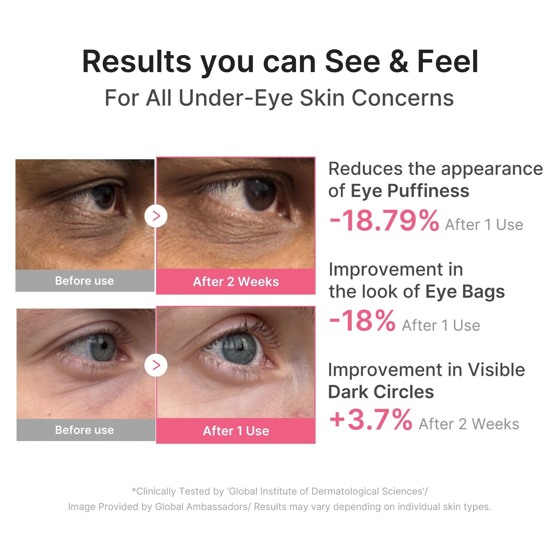 pdrn-caffeine-collagen-eye-patch-l7 PDRN_03_cdce2143-b8d8-43cb-ac69-fcbdf6640249.jpg