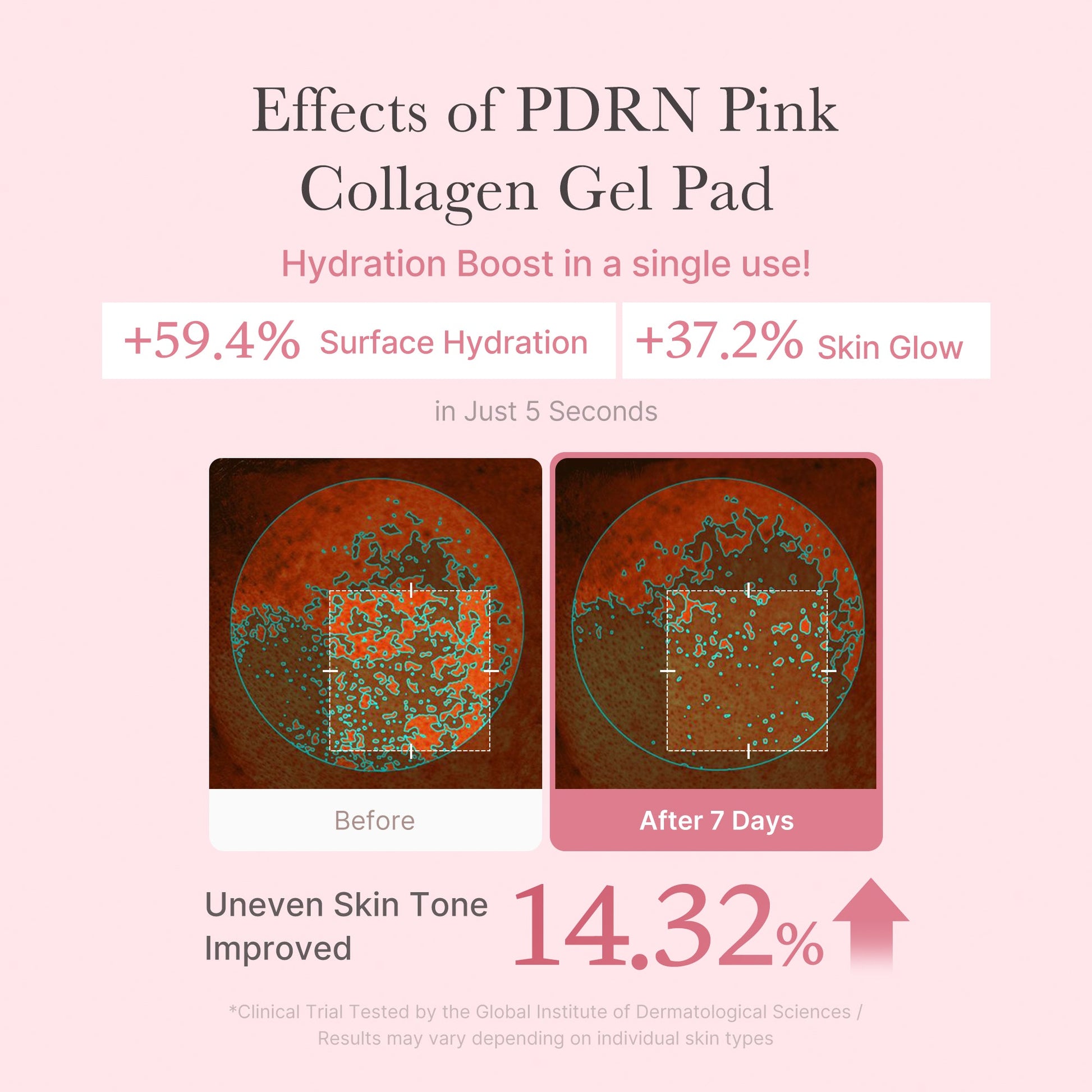 pdrn-pink-collagen-gel-toner-pad-l5 PDRN_04_f9a16a56-8d9e-4c47-a635-ed34ec3ed571.jpg