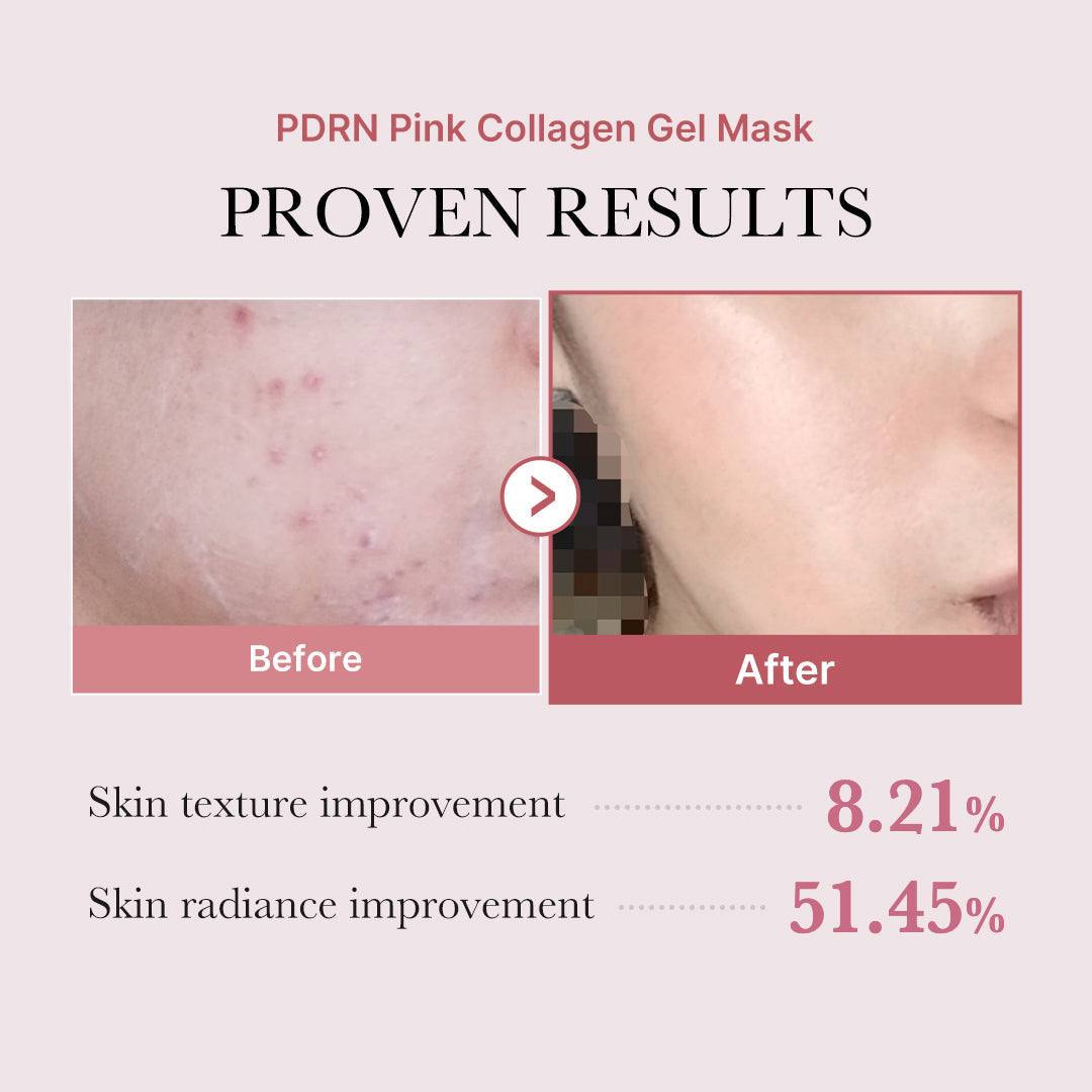 pdrn-pink-glow-full-set-c4 PDRN_12.jpg
